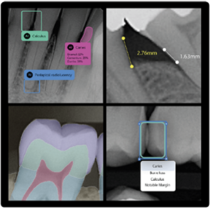 Pear AI at Djawdan Center for Implant and Restorative Dentistry