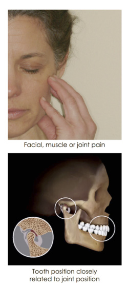 Picture of woman in pain holding her jaw along with a picture of skeletal x-ray of her jaw joint in Annapolis, MD near Djawdan Center for Implant and Restorative Dentistry. 