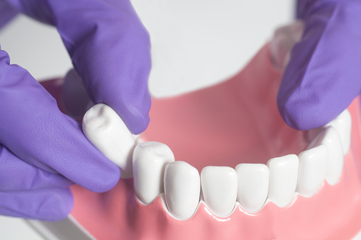 What is Endodontic Surgery?