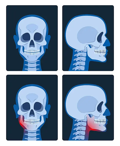 Cranial x-rays reveal detailed images of the jaw and the skull, with jaw section highlighted and in need of trauma surgery.