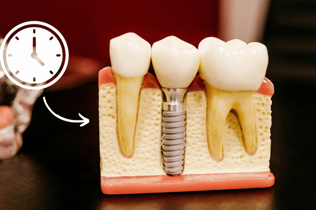 Dental Implants Last a Lifetime banner