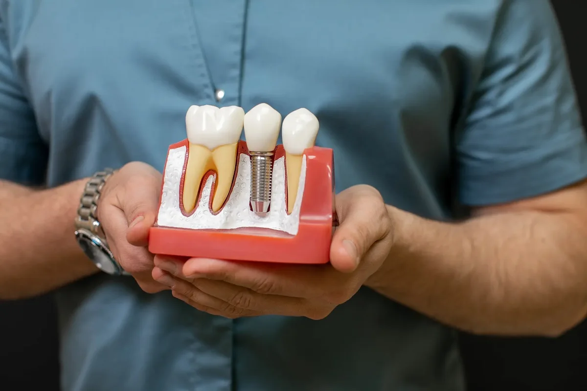 Types of Dental Implants banner